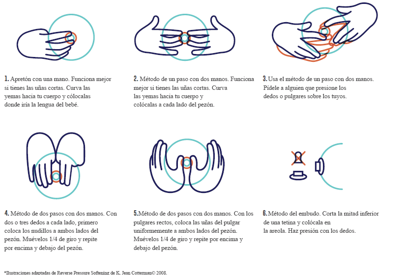Ilustración y explicación de las seis formas de sostener los pezones para la técnica de presión inversa suavizante.